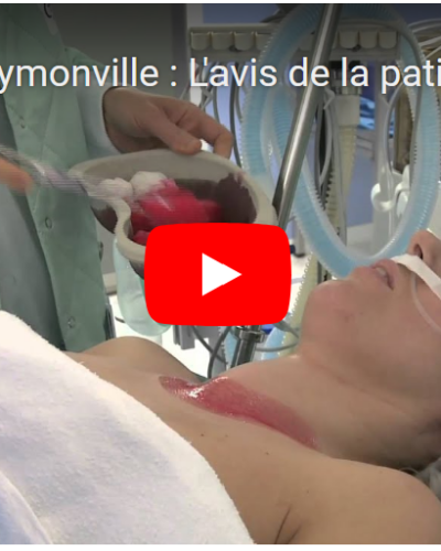 M.E. Faymonville : l&rsquo;avis de la patiente